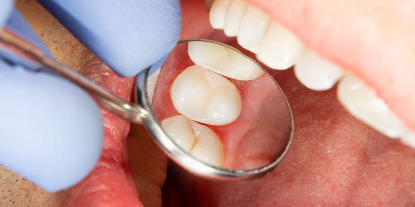 Emergency Dentist Emergency Dentist