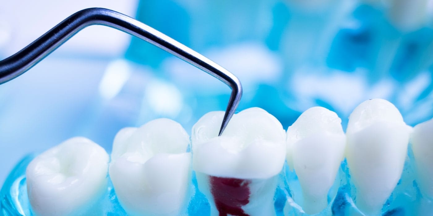 Oral Surgery Oral Surgery